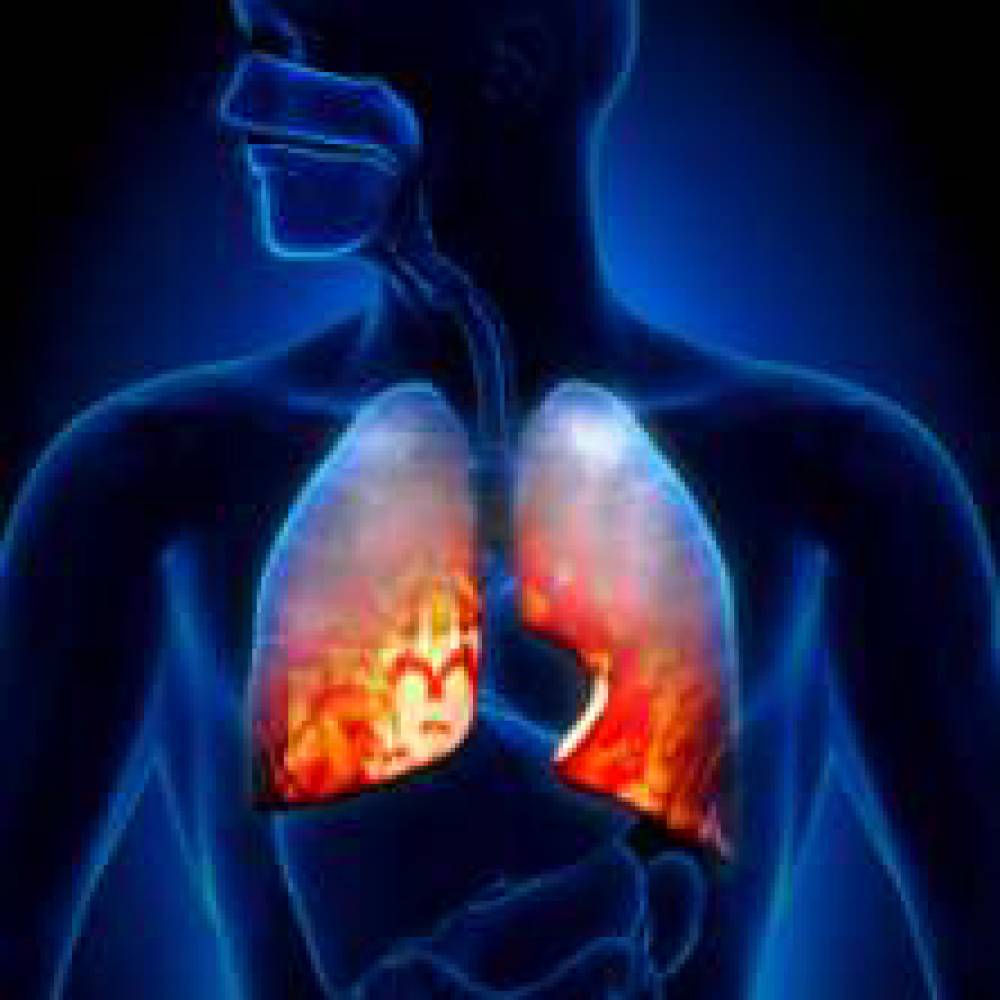 Respiratory Panel (Comprehensive)
